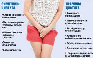 Цистит у женщин: диагностика, симптомы и лечение