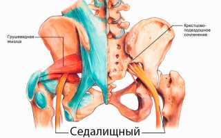 Ой, защемило седалищный нерв: причины, симптомы, лечение