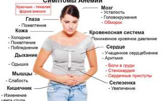 Анемия у женщин-причины и правила лечения пониженного гемоглобина