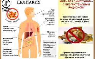Что такое глютен и чем он опасен для здоровья человека?