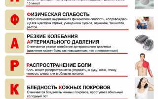 Инфаркт: инструкция по выживанию