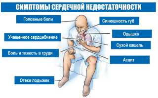 Как по кашлю понять, что сердце просит о помощи