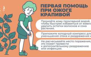 Ожог крапивой —  последствия и первая помощь пострадавшему