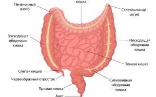 Рак ободочной кишки: симптомы, диагностика, лечение